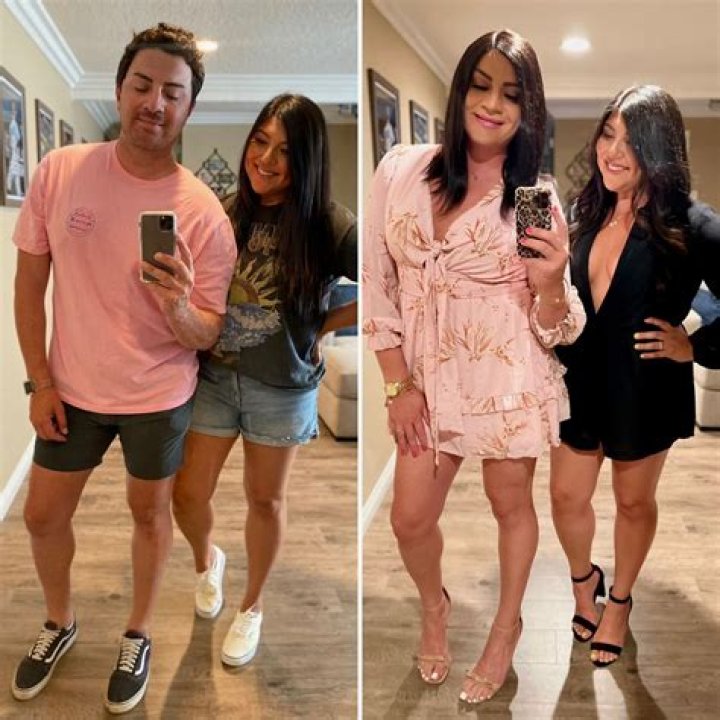 Alanna Panday's Surgery Journey: Before And After Transformation