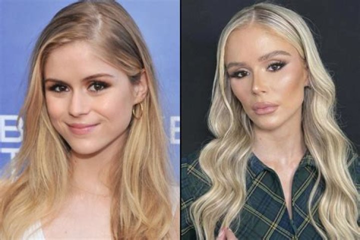 Alanna Panday's Transformation: Before And After Plastic Surgery
