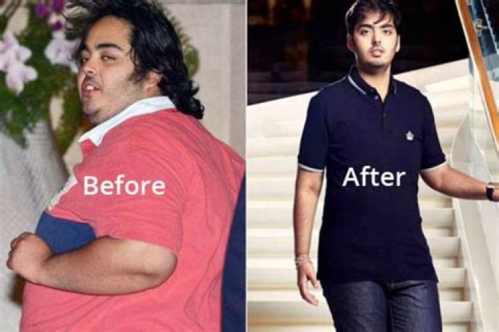 Anant Ambani's Transformative Journey: The Truth Behind His Fat Surgery