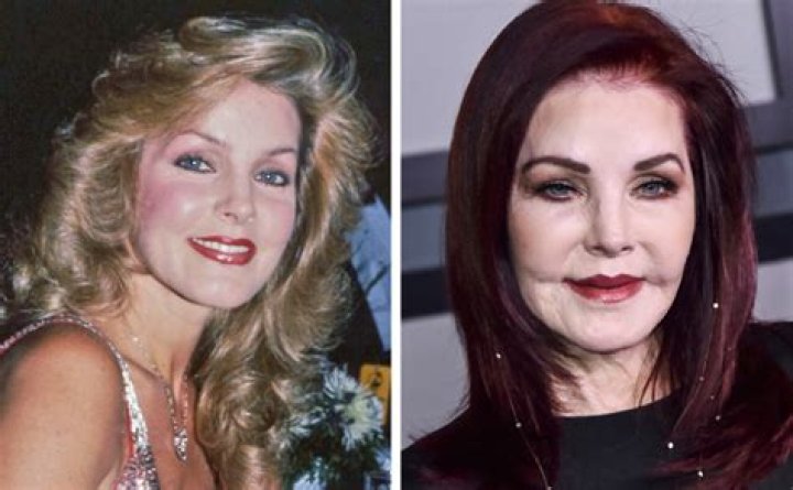 Behind The Screens: Exploring News Anchors Who Have Had Plastic Surgery