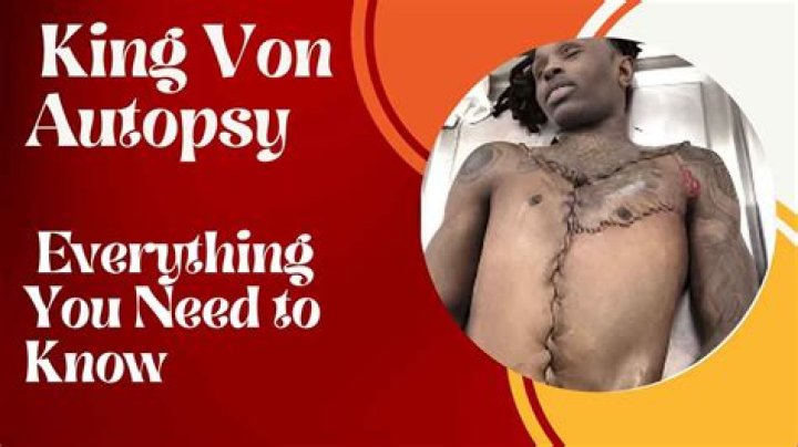 Comprehensive Guide To Von Autopsy: Unraveling The Mysteries Of Human Remains