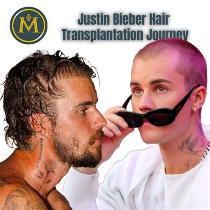 Did Justin Bieber Pass Away Today? Uncover The Truth