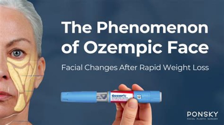Enhanced Vision With Ozempic: Unlocking Clearer Sight