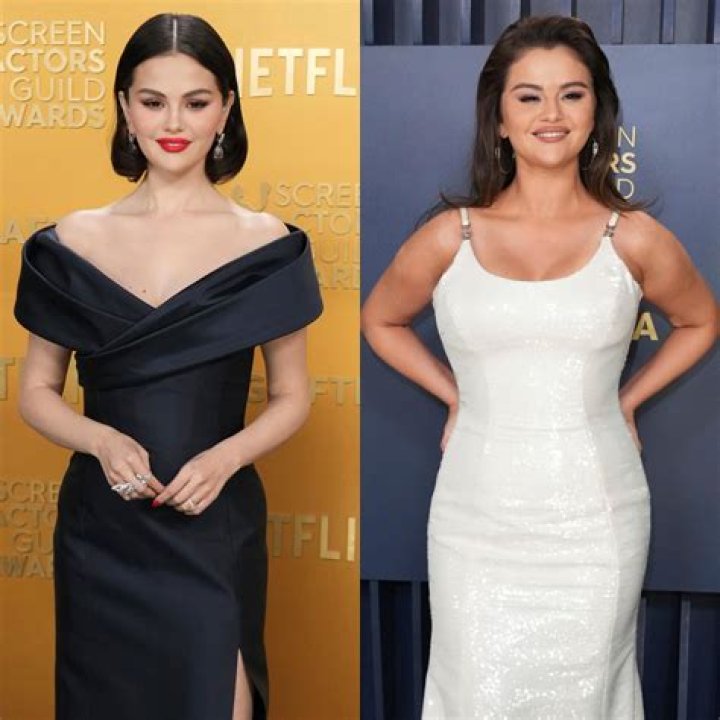 How Selena Gomez Transformed Her Look Before Surgery
