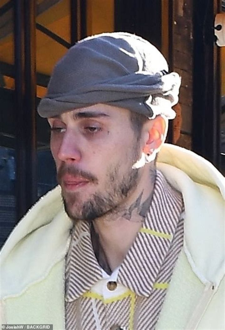Justin Bieber's Drug Abuse: A Shocking Revelation