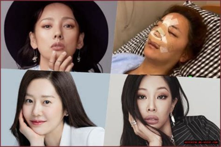 Korean Celebrity Plastic Surgery: Insights Into The Industry