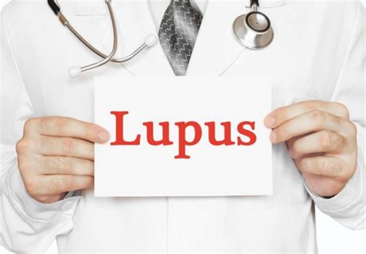 Lupus Treatment Advance: Exploring Semaglutide's Potential