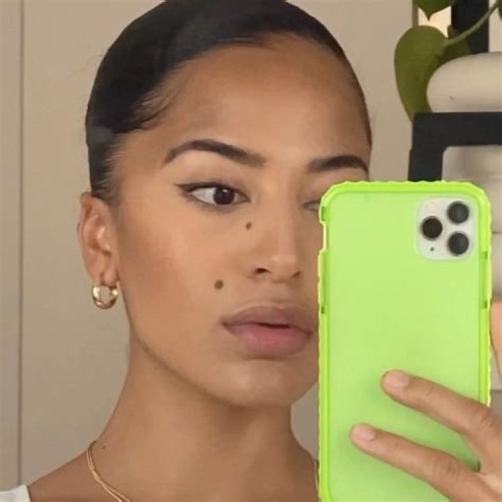 Meet The Phenomenal Sydney Utendahl: Trailblazing Model And Advocate