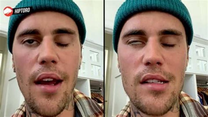 Shocking News! Justin Bieber's Health Condition Deteriorates
