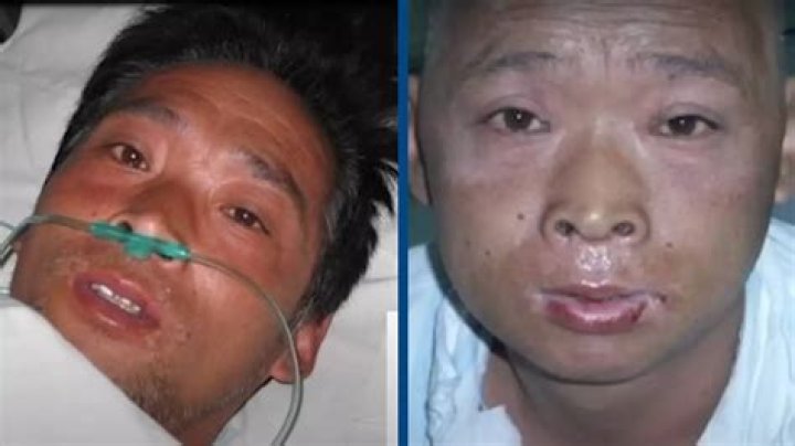 The Gruesome Details Of Hisashi Ouchi's Autopsy Report Revealed