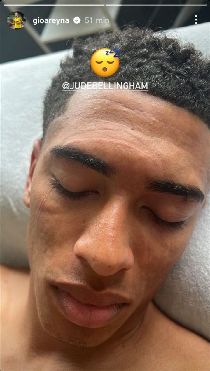 The Truth About Jude Bellingham's Skin Colour