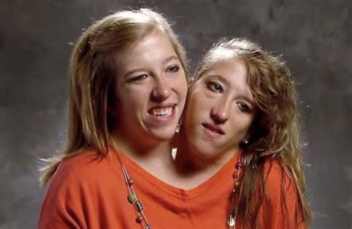 Tragic Loss: The Untimely Passing Of Conjoined Twins Abby And Brittany Hensel
