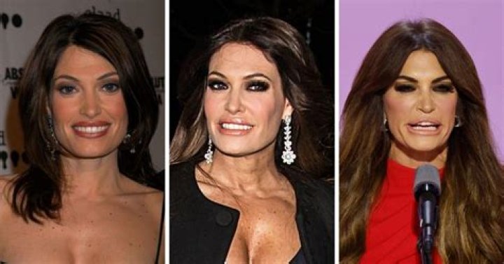 Transformation And Controversy: Kimberly Guilfoyle After Plastic Surgery