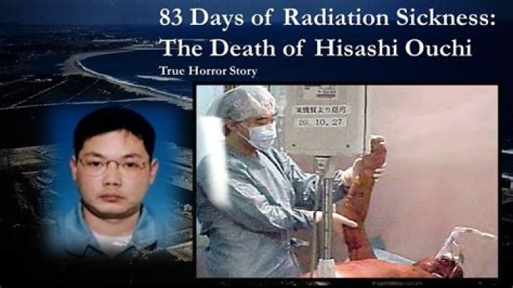 Unseen Images: Hisashi Ouchi's Tragic Injuries Revealed