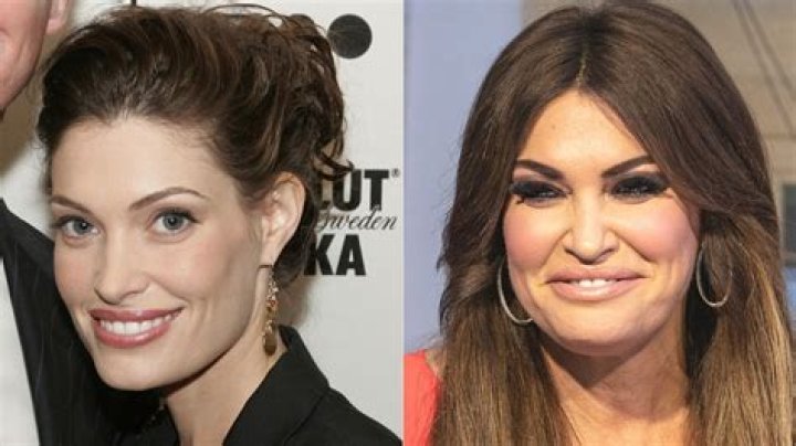 Unveiling The Transformation: Kimberly Guilfoyle's Face Before And After